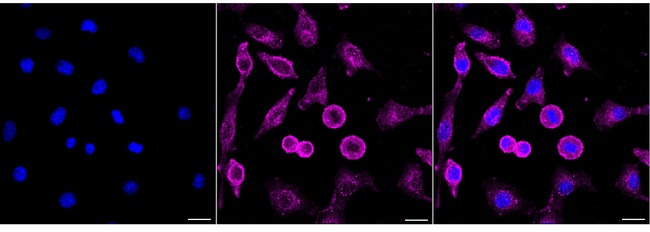 ELP3 Antibody in Immunocytochemistry (ICC/IF)