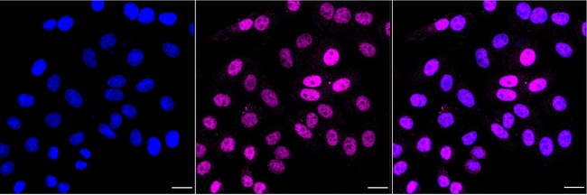 ELK1 Antibody in Immunocytochemistry (ICC/IF)