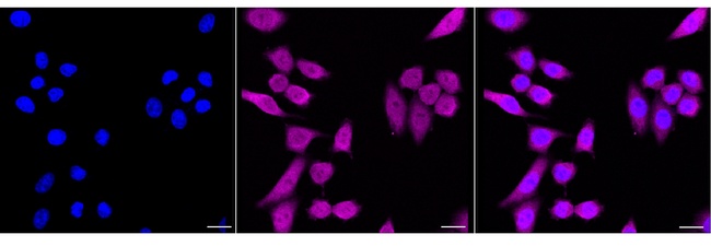 eIF5A Antibody in Immunocytochemistry (ICC/IF)
