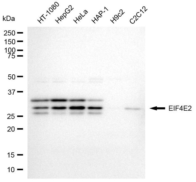 eIF4E2 Antibody in Western Blot (WB)