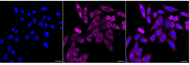eIF4E Antibody in Immunocytochemistry (ICC/IF)