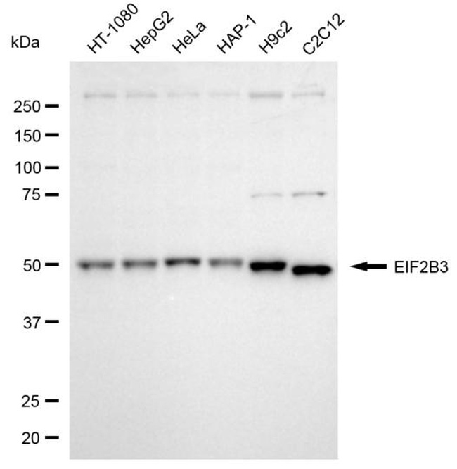 eIF2b gamma Antibody in Western Blot (WB)
