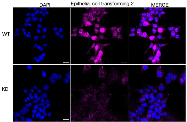 ECT2 Antibody in Immunocytochemistry (ICC/IF)