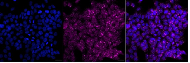 E6AP Antibody in Immunocytochemistry (ICC/IF)