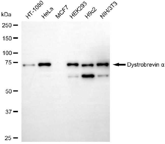 DTNA Antibody in Western Blot (WB)
