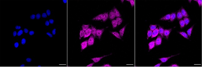 DPP9 Antibody in Immunocytochemistry (ICC/IF)