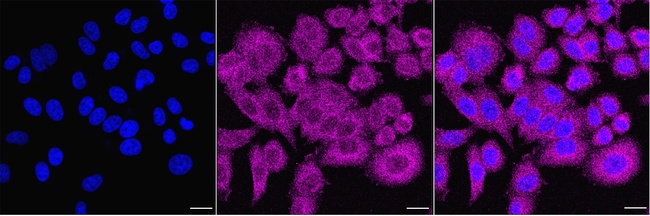 DPP9 Antibody in Immunocytochemistry (ICC/IF)