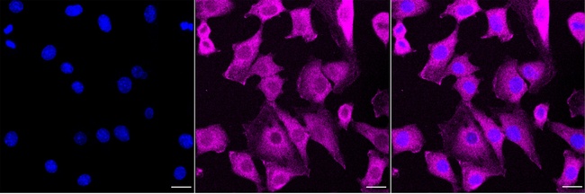DNAJA2 Antibody in Immunocytochemistry (ICC/IF)