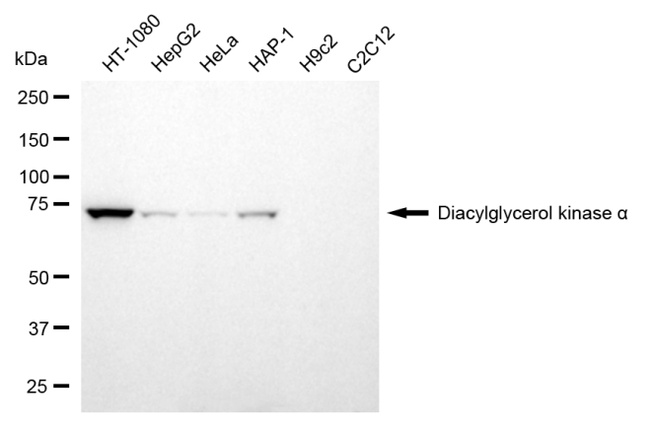 DGKA Antibody in Western Blot (WB)