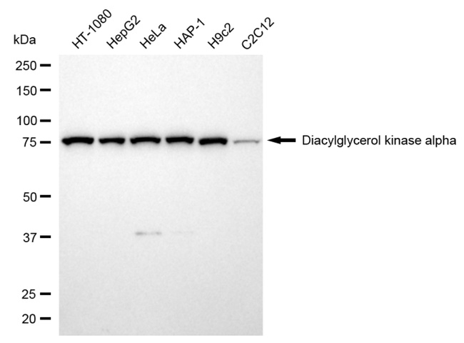 DGKA Antibody in Western Blot (WB)