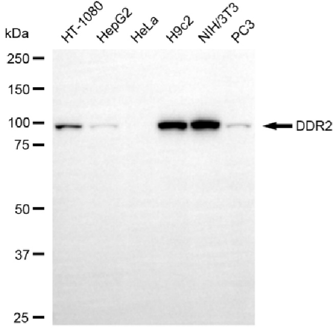 DDR2 Antibody in Western Blot (WB)