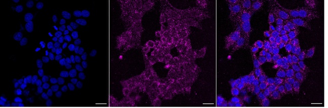 DCI Antibody in Immunocytochemistry (ICC/IF)