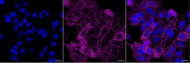 DAB2 Antibody in Immunocytochemistry (ICC/IF)