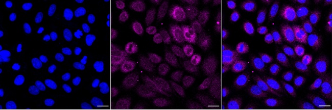 Cytochrome P450 Reductase Antibody in Immunocytochemistry (ICC/IF)