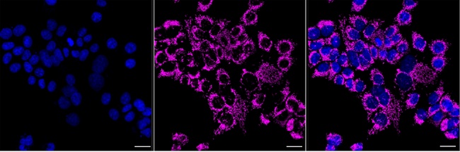 CYP7B1 Antibody in Immunocytochemistry (ICC/IF)