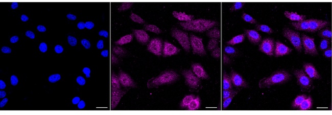 Cyclin B2 Antibody in Immunocytochemistry (ICC/IF)