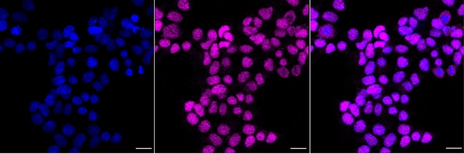 CWC27 Antibody in Immunocytochemistry (ICC/IF)