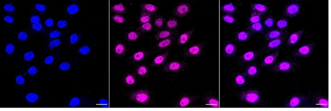 Cullin 2 Antibody in Immunocytochemistry (ICC/IF)