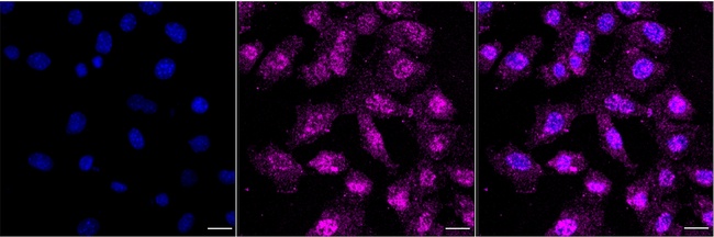 Cullin 5 Antibody in Immunocytochemistry (ICC/IF)