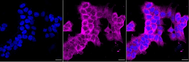 CRMP5 Antibody in Immunocytochemistry (ICC/IF)