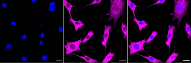 CRMP2 Antibody in Immunocytochemistry (ICC/IF)