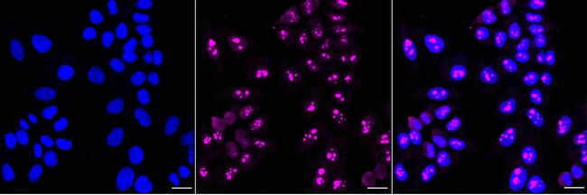 CRCP Antibody in Immunocytochemistry (ICC/IF)