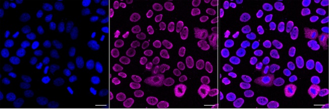 CPSF6 Antibody in Immunocytochemistry (ICC/IF)