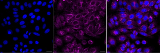 COMMD1 Antibody in Immunocytochemistry (ICC/IF)