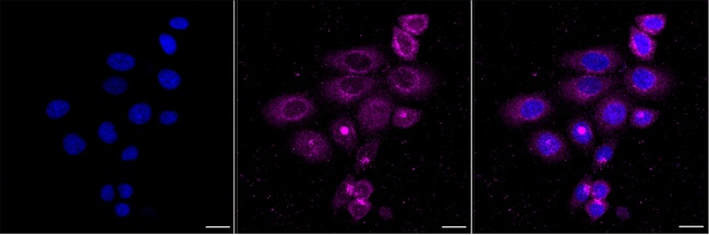 COMMD1 Antibody in Immunocytochemistry (ICC/IF)