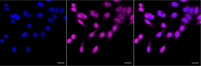 Coilin Antibody in Immunocytochemistry (ICC/IF)