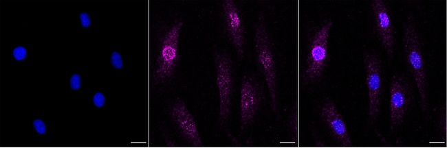 CNDP2 Antibody in Immunocytochemistry (ICC/IF)