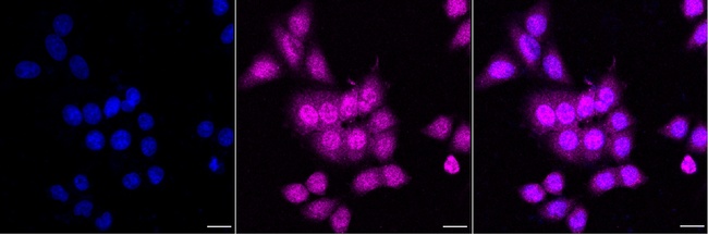 CMPK1 Antibody in Immunocytochemistry (ICC/IF)