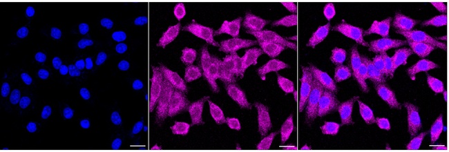 Clathrin Heavy Chain Antibody in Immunocytochemistry (ICC/IF)