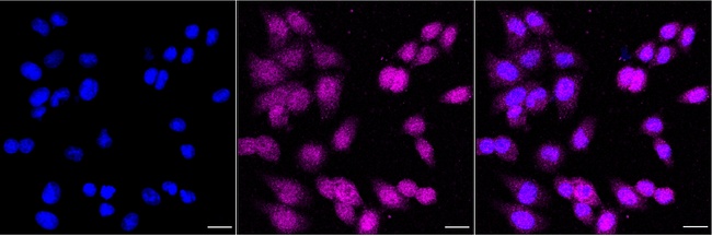 Chk1 Antibody in Immunocytochemistry (ICC/IF)