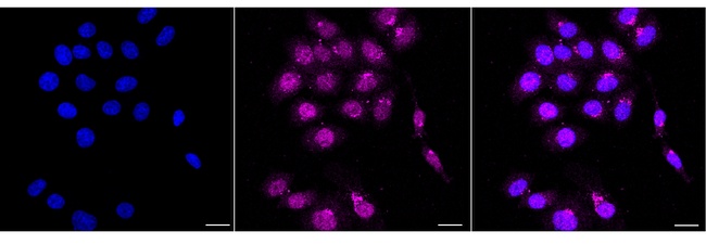Chk1 Antibody in Immunocytochemistry (ICC/IF)
