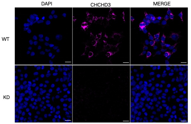 CHCHD3 Antibody in Immunocytochemistry (ICC/IF)