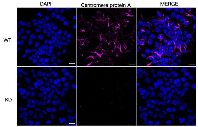 CENPA Antibody in Immunocytochemistry (ICC/IF)
