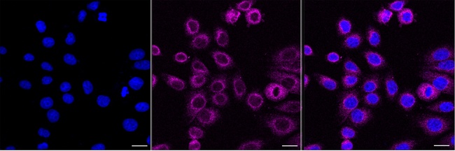 CDK5RAP3 Antibody in Immunocytochemistry (ICC/IF)