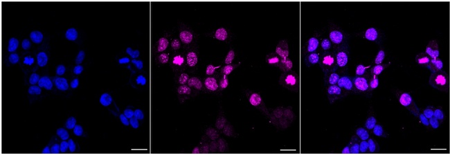 CDCA8 Antibody in Immunocytochemistry (ICC/IF)