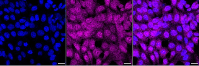 CDC34 Antibody in Immunocytochemistry (ICC/IF)