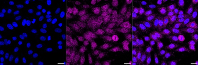 CDA Antibody in Immunocytochemistry (ICC/IF)