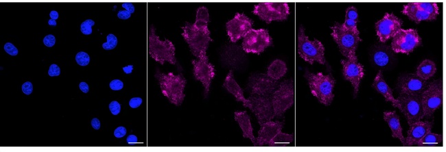 ITGA2 Antibody in Immunocytochemistry (ICC/IF)