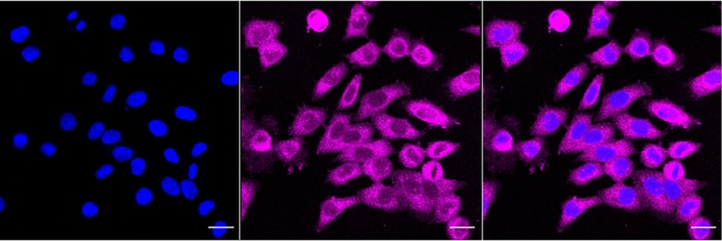 CD206 Antibody in Immunocytochemistry (ICC/IF)