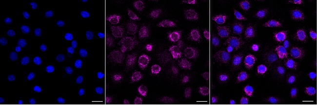 IFNGR1 Antibody in Immunocytochemistry (ICC/IF)
