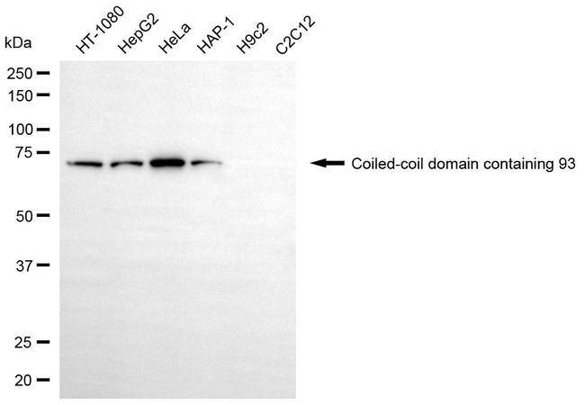 CCDC93 Antibody in Western Blot (WB)