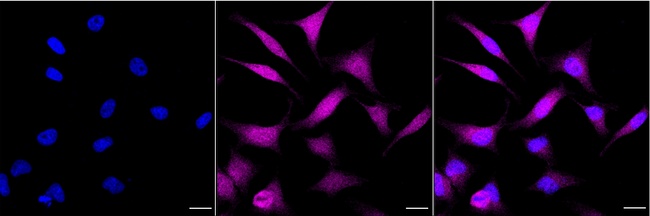 CBR1 Antibody in Immunocytochemistry (ICC/IF)