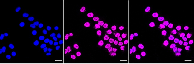 CaMKIV Antibody in Immunocytochemistry (ICC/IF)