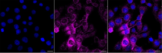 Calponin 2 Antibody in Immunocytochemistry (ICC/IF)
