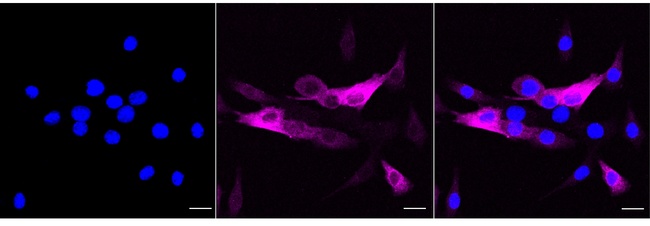 Calponin 1 Antibody in Immunocytochemistry (ICC/IF)