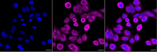 C21orf59 Antibody in Immunocytochemistry (ICC/IF)
